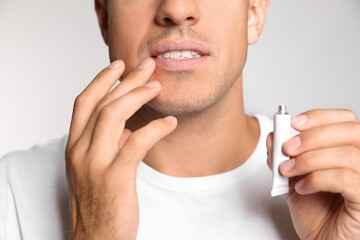 Man with herpes applying cream on lips against light grey background, closeup