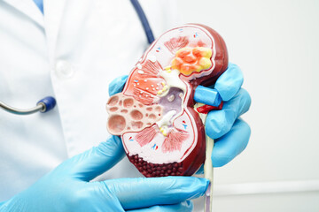 Chronic kidney disease, doctor with model for treatment urinary system, urology, Estimated glomerular filtration rate eGFR.