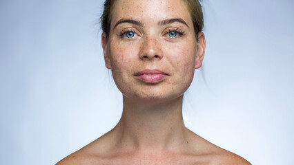 Beautiful girl with freckles shows emotions in front of the camera on a white background