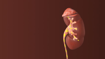 Human kidney infection medical animation