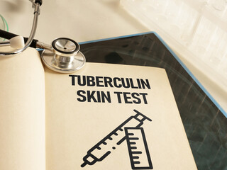 Tuberculin skin test is shown using the text