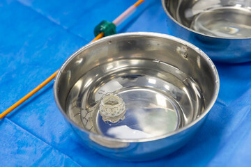 Heart valve surgery cardiology for patient in hospital. Prepare Transcatheter aortic valve...