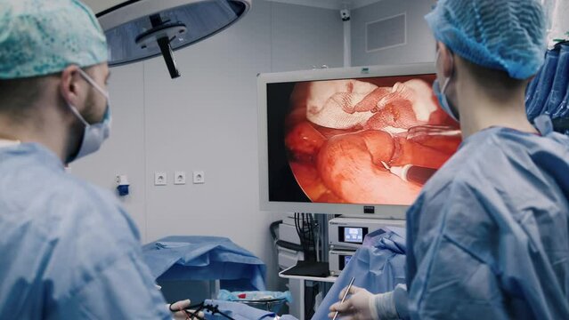 Professional surgeons in the operating room. Instrument for laparoscopic surgery. A surgeon performs laparoscopic gastric surgery in the operating room.