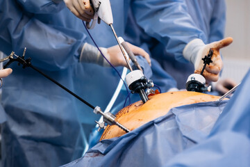 A group of medical surgeons in the operating room during an operation. A patient on the operating...