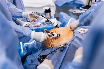 A group of medical surgeons in the operating room during an operation. A patient on the operating...