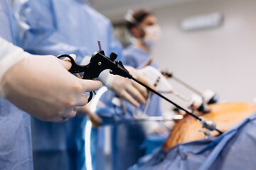 Professional surgeons in the operating room. Instrument for laparoscopic surgery. A surgeon...