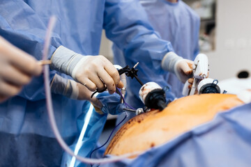 A medical team performs a surgical operation in a modern operating room. Concept of surgical...