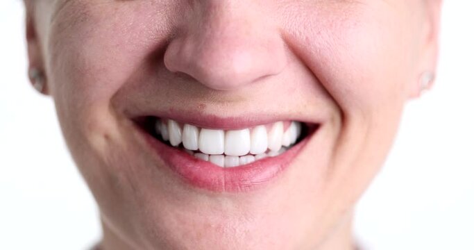 Woman smiling with beautiful snow white smile closeup. Dental treatment and prosthetics concept