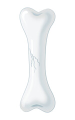 ひびの入った骨