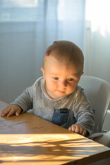 Seven month old baby child sitting on chair. Cute smiling little infant boy. Baby boy with Hemangioma on head sitting in high chair ready for eating