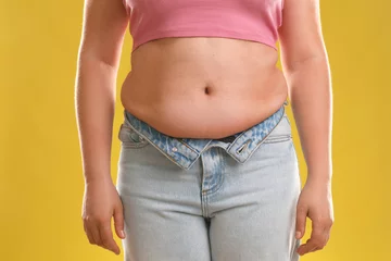 Tuinposter Woman with excessive belly fat on goldenrod background, closeup. Overweight problem © New Africa