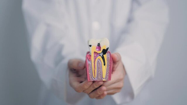 Dentist with tooth Anatomy model. Oral Teeth decay and disease, Scrape off tartar. March Oral health, Dentist Day, False Teeth. Toothache and Children Dental Health Month and Orthodontic Health Day