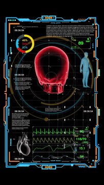 X-ray image displayed Skull and Medical Data Display on computer monitor with digital interface, Concepts of health science, medicine and technology, Vertical video size 4K 9:16