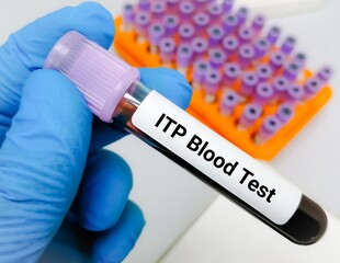Immune thrombocytopenic purpura (ITP) test, ITP is a blood disorder characterized by a decrease in...