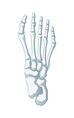 リウマチの足の骨