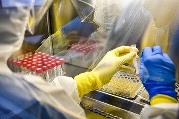 Scientist working in a laboratory, closeup of hands with gloves
