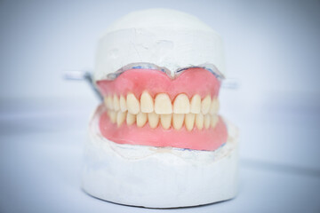 Dental prostheses, dental concept. stock photo