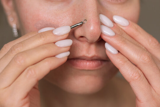 A close-up photo of a young Caucasian woman cleaning her nose from black dots with a special tool. She squeezes out comedones for herself. Cosmetology and dermatology. Acne and pimples. Clogged pores