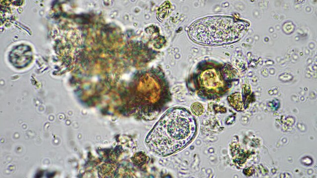 Soil microorganisms in a compost sample including bacteria, testate amoeba, flagellates. regenerative agricultural farm. Soil testing agriculture agronomy done for farmers for carbon sequestration