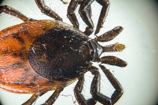 Tick Under the Microscope