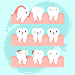 Teeth pack for dentistry business. Teeth caries, dental braces, wisdom tooth