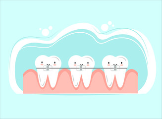 Dental Braces Vector Illustration with Cute Kawaii Teeth for Dentistry Business