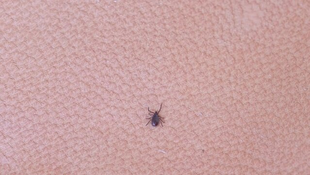 parasitiform tick Ixodidae, blood-sucking parasites crawls on skin, Acariformes, carrier of dangerous disease encephalitis, illness symptoms, tick-borne disease prevention strategies, research studies