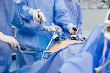 Doctor in blue sterile surgical gown doing surgery with camera and instrument. Keyhole surgery was perform in modern operating room. Advanced laparoscopy - obrazy, fototapety, plakaty