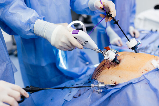Instruments for gastroscopy and colonoscopy close-up. The doctor holds a flexible endoscope and biopsy forceps in his hands. Endoscopy and minimally invasive surgery