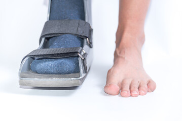 close up Woman with Sprained or Fractured Foot Wearing a Walking Boot, White Background