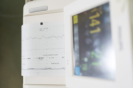 Monitoring uterine contractions during pregnancy