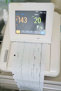 Monitoring uterine contractions during pregnancy