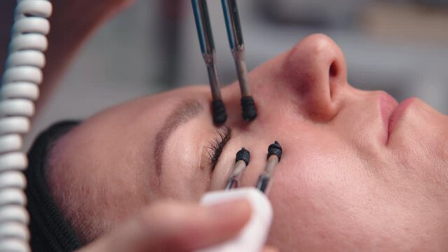 A middle-aged woman undergoes electrotherapeutic facial rejuvenation procedures in a cosmetologist's office.