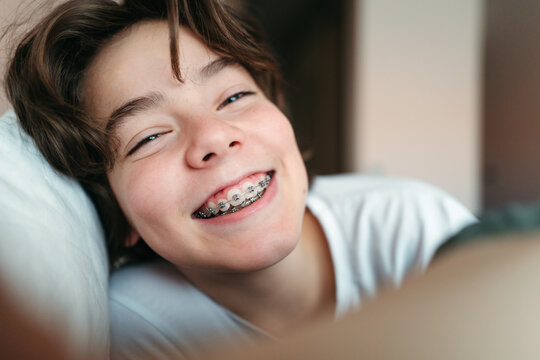 Young laughing boy with dental brackets.