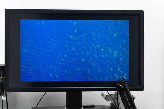 Microbiology Sample View On The Screen