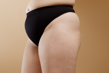 Unaltered , natural skin and body with stretch marks . Real woman body without retouching....