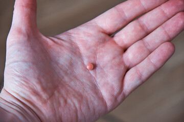 A blood-thinning pill lies on a man's palm. Prevention of blood clot formation. Close-up.