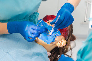 Dentist is working and making the treatments on a patient wearing rubber dam and protection glasses.