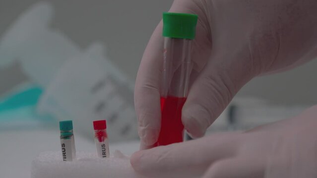 Clinical Analysis in Progress Test Tubes, Blood and Laboratory Equipment