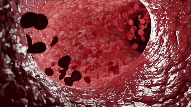 Movement of red bloodstream cells within human blood vessels, Red Blood cells flow through veins, Human body system, motion graphic shows an animation of a blood vessel with antibodies and red blood.