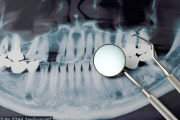 Dental x-ray and dentist tool, close-up. Dental background