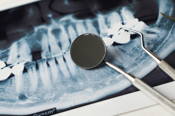 Dental x-ray and dentist tool, close-up. Dental background