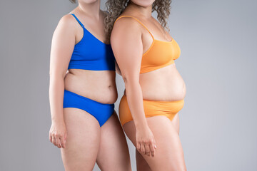 Two overweight women with cellulitis, fat flabby bellies, legs, hands, hips and buttocks on gray background, obese female body, liposuction and plastic surgery concept - 779509911