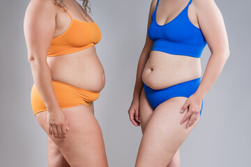 Two overweight women with cellulitis, fat flabby bellies, legs, hands, hips and buttocks on gray background, obese female body, liposuction and plastic surgery concept - 779509988