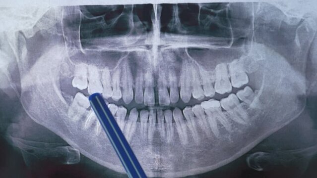Dentist demonstrates x-ray of patient's tooth on monitor. 