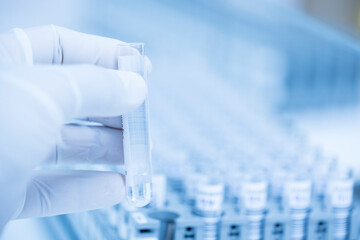 Doctor hand wearing white glove holding blood test tube for HPV, Human papilloma virus DNA...