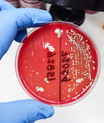Streptococcus bacterial colonies with beta hemolytic on blood agar plate, medical background....