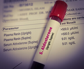 Blood sample for Aldosterone hormone test with report. - obrazy, fototapety, plakaty