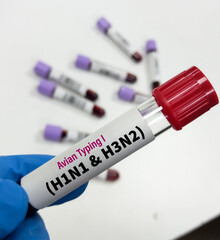 Blood Sample for Avian typing I (H1N1 and H3N2) test, avian influenza virus (AIV), avian flu or bird flu.