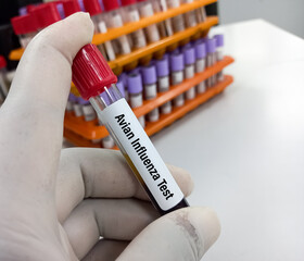 Blood Sample for H5N1 (Avian Influenza virus) test, avian influenza virus (AIV), avian flu or bird...